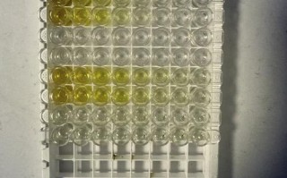 细胞上清代谢组学前处理关键步骤有哪些？