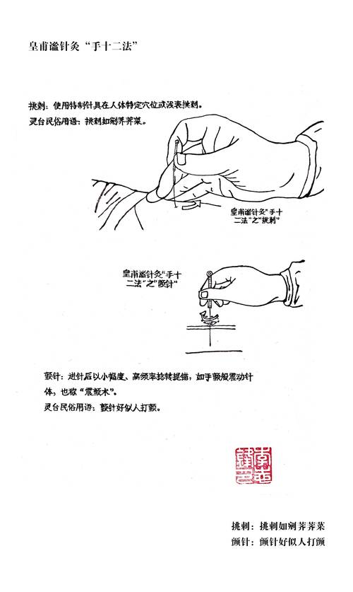 针灸免费自学教程视频哪里找？-第2张图片-指南针培训网