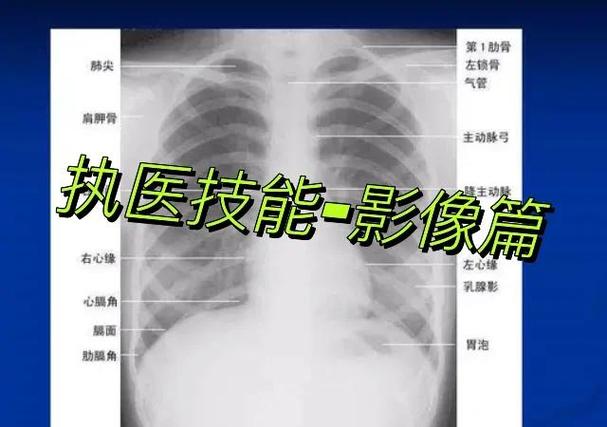 医学影像学自学可行吗?-第2张图片-指南针培训网 医学影像学自学可行吗?-第2张图片-指南针培训网