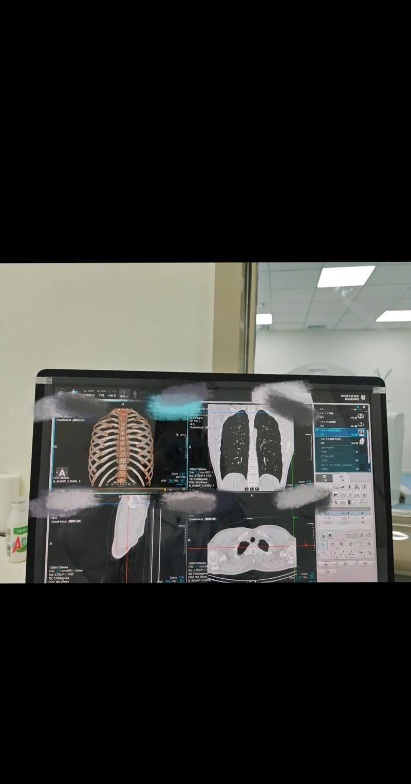 医学影像学自学可行吗?-第3张图片-指南针培训网 医学影像学自学可行吗?-第3张图片-指南针培训网