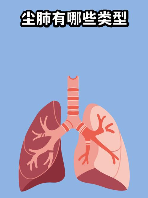 煤矿职业健康如何发展？思路何在？-第3张图片-指南针培训网